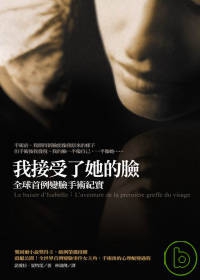 我接受了她的臉──全球首例變臉手術紀實
